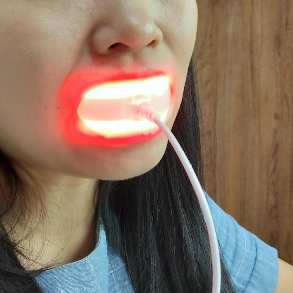 Clinic Red Laser Oral Therapy  - Healing Wellness 리뷰 및 가격
