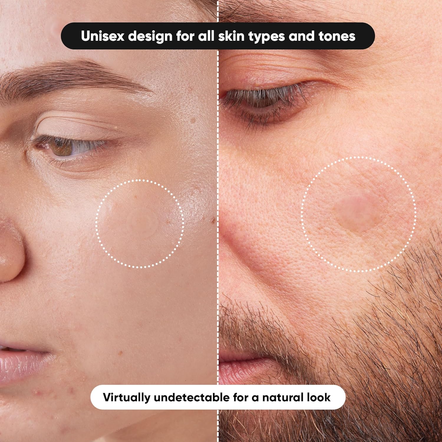 80/ 800PCS Hydrocolloid Acne P - Healing Wellness 리뷰 및 가격