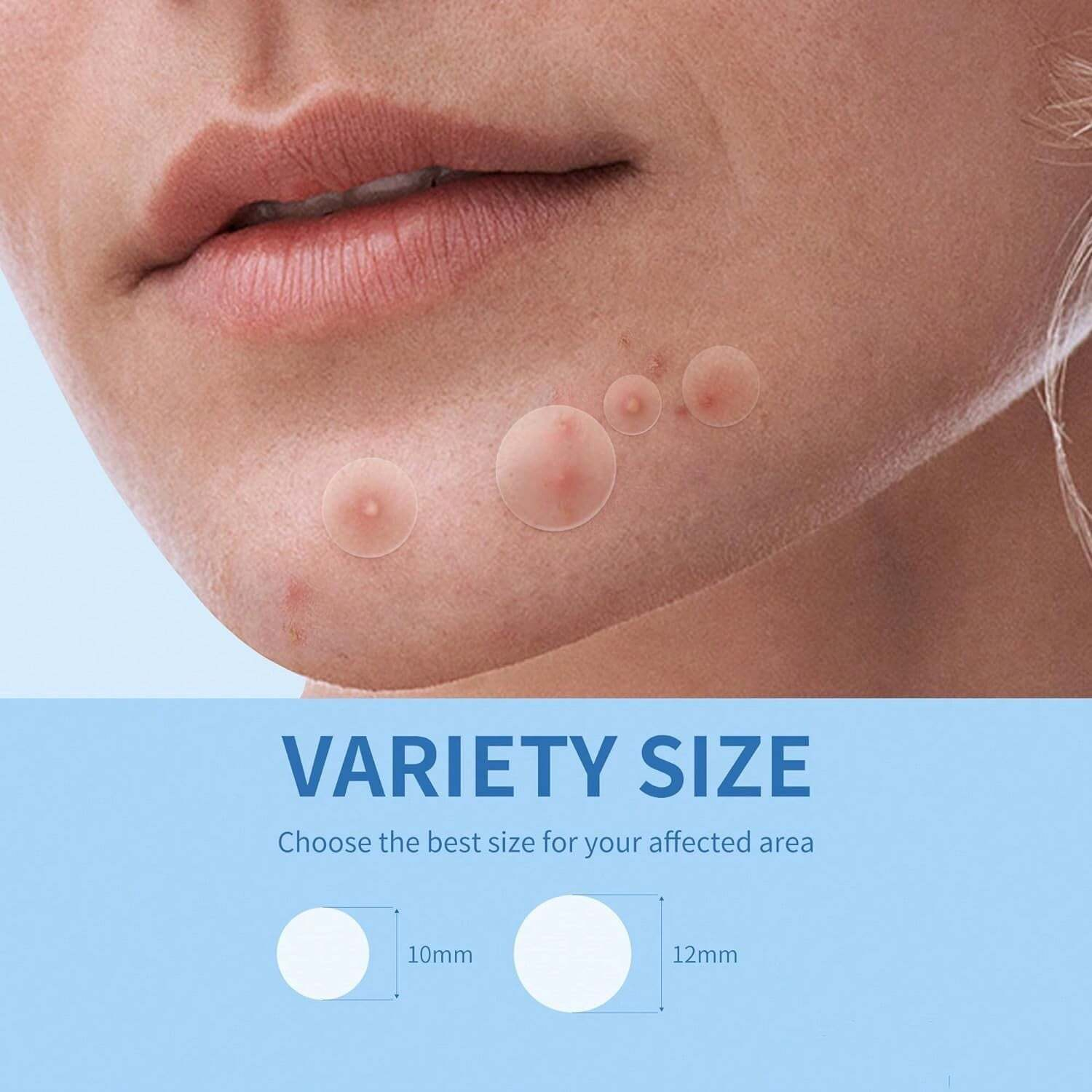 80/ 800PCS Hydrocolloid Acne P - Healing Wellness 리뷰 및 가격